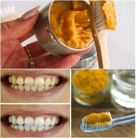 Secret that Dentists Don’t Want You to Know: Remove Tartar and Whiten Teeth in Just 2 Minutes with Turmeric