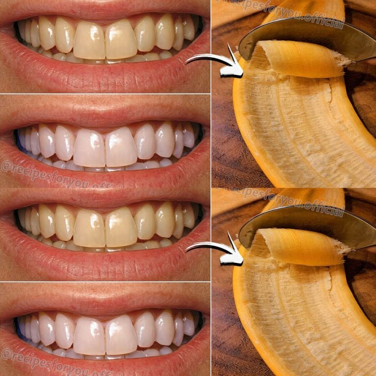 Quick Teeth Whitening with Banana Peels: Transform Yellow Teeth to Shiny White in Just 2 Minutes!