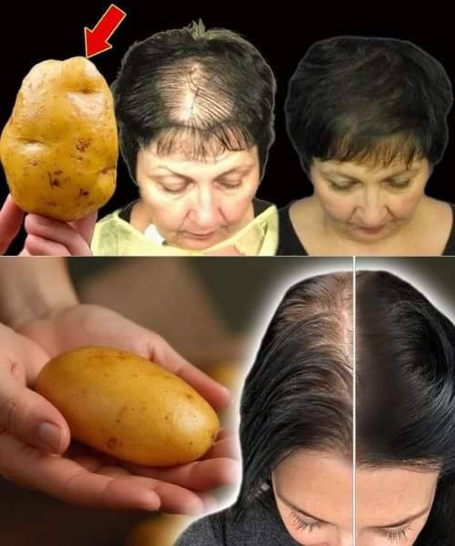 Unlock Rapid Hair Growth with This Powerful Potato Recipe!